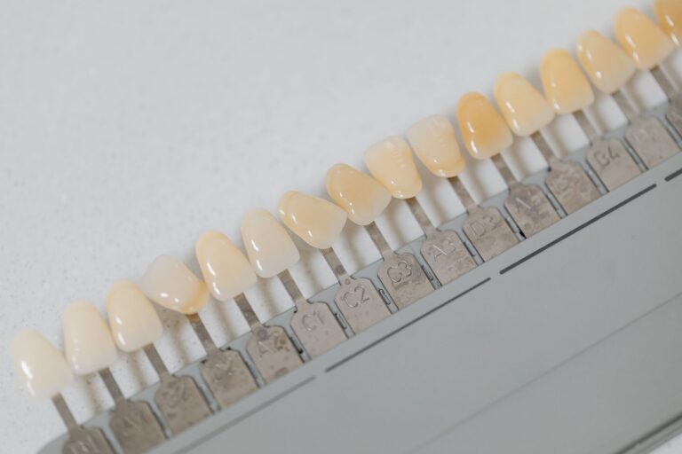 Cheie de culori dentare folosită pentru alegerea nuanței potrivite a unei lucrări estetice