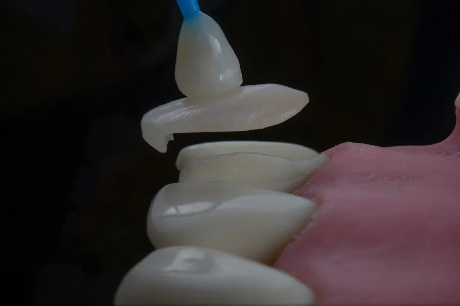 dental implant procedure steps