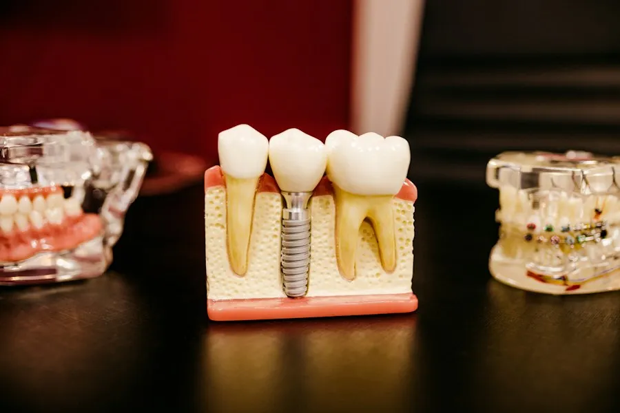 Photo dental implant aftercare tips