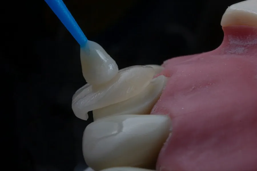 Photo proper tooth brushing technique