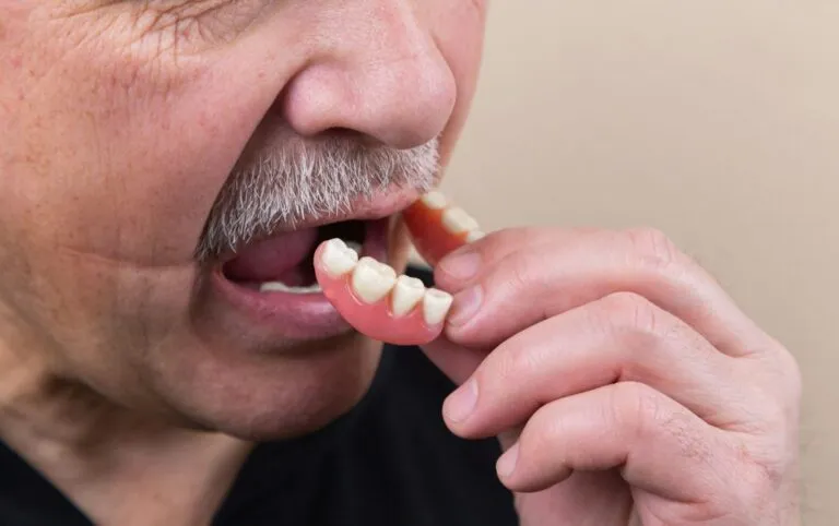 Tot ce trebuie să știi despre proteza dentară Photo dental prosthesis guide