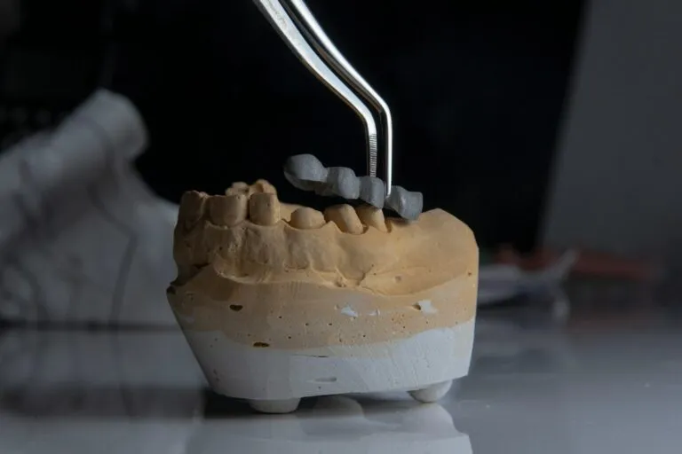 Photo dental implant failure long-term