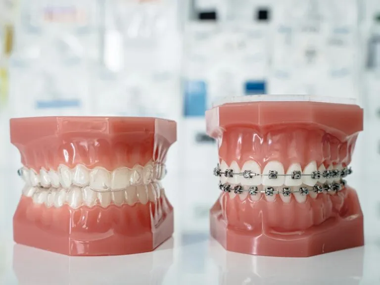 Photo dental braces information
