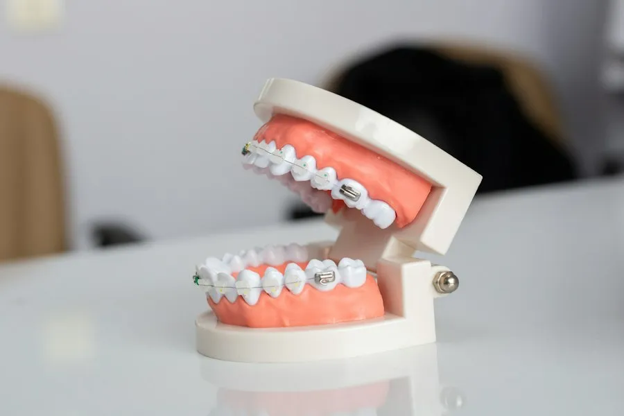 dental braces information