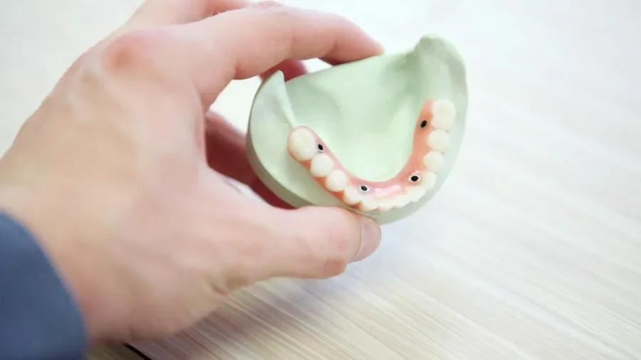 dental implant explained