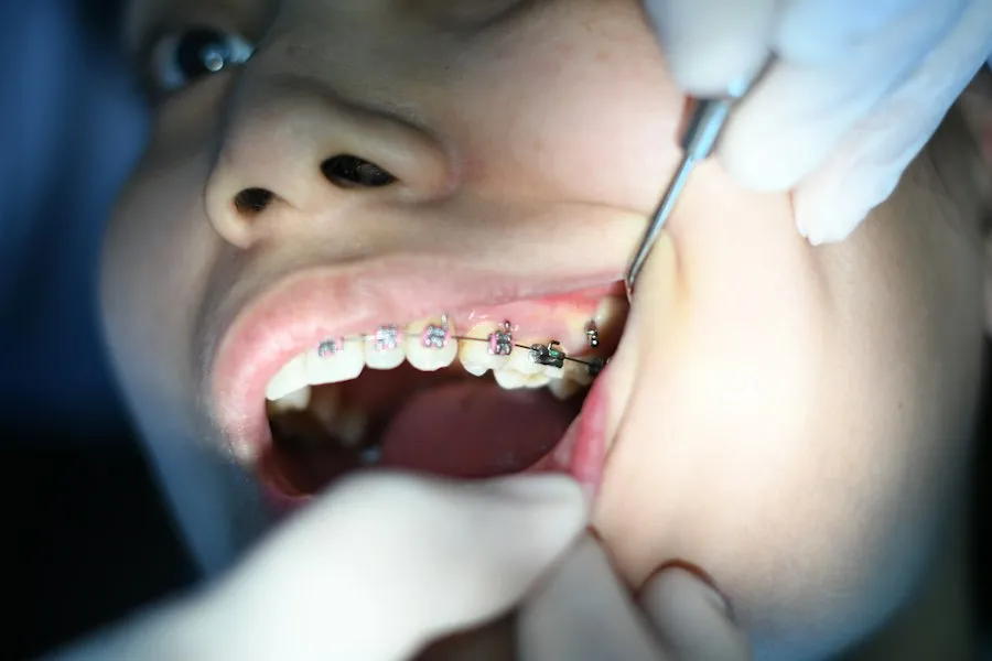 Photo dental checkup routine