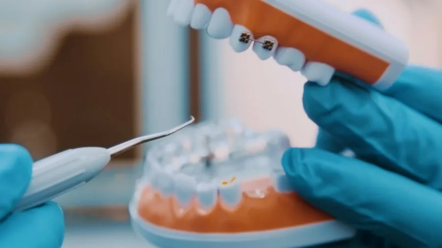 Photo dental implant guide expert insights recent data