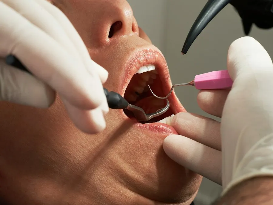 Photo dental implant procedure steps research-based recommendations