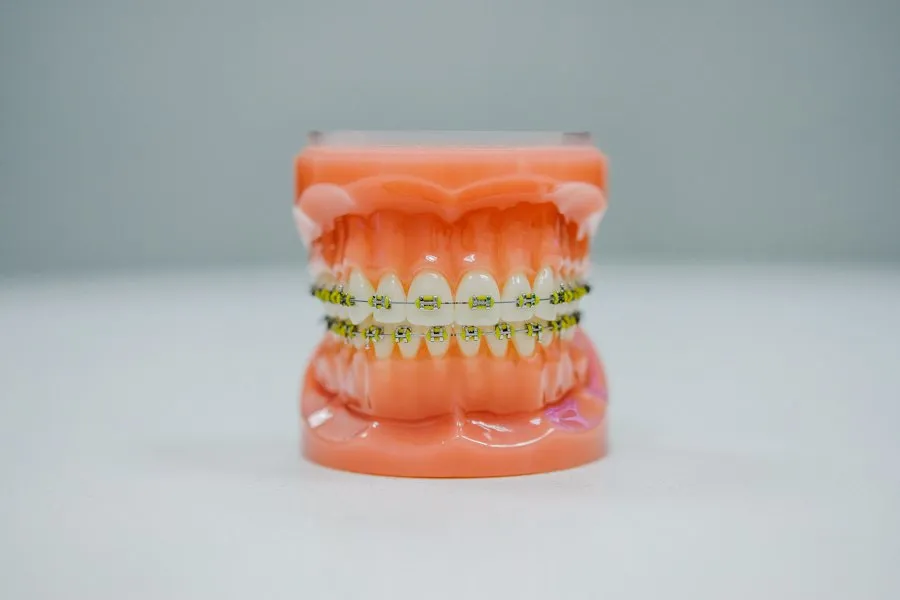 common braces mistakes